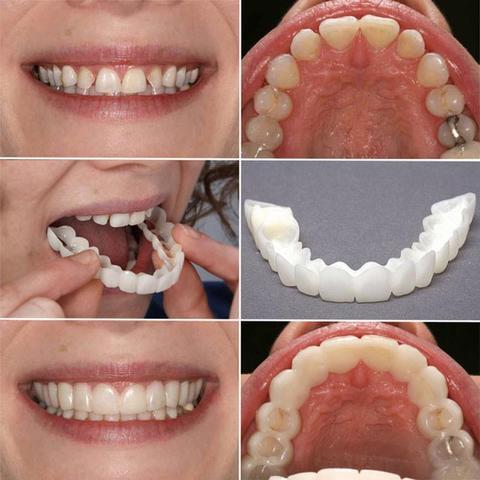 Dentier Amovible Réutilisable